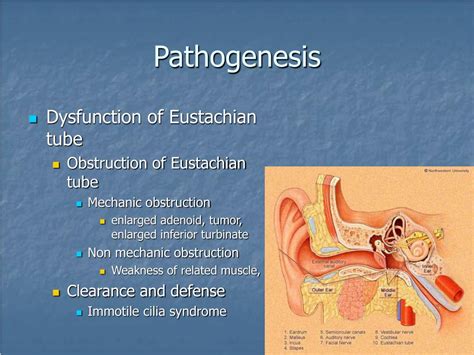 Ppt Otitis Media And Eustachian Tube Dysfunction Powe