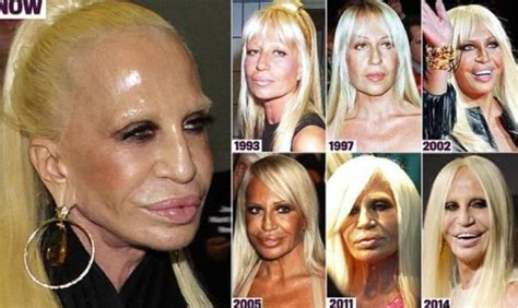 17 Worst Celebrities Plastic Surgeries Fails That Would Make You Think