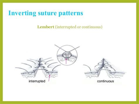 Basic Suture Patterns Sutures Pattern Veterinary Surgery