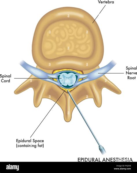 Epidural Space Hi Res Stock Photography And Images Alamy