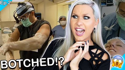 Did He Fix Her Botched Plastic Surgery Dr 90210 S1 E2 Luxeria Youtube