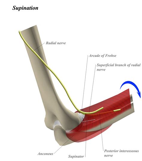 Radial Head Lateral Approach Approaches Orthobullets