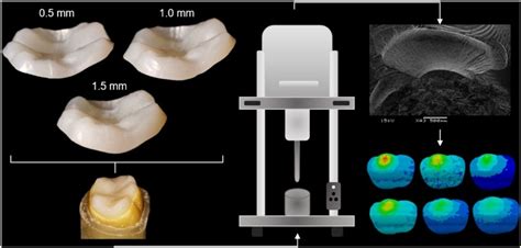 Resin Matrix Ceramics For Occlusal Veneers Effect Of Thickness On