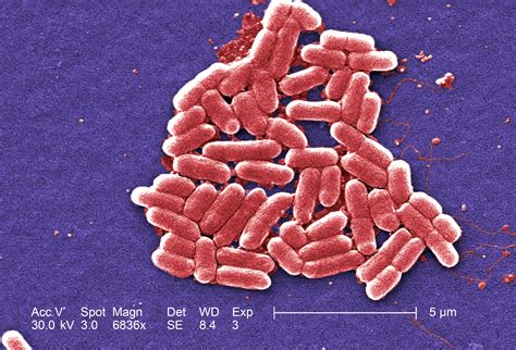 Free Picture Gram Negative Escherichia Coli Bacteria