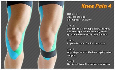 1000 Images About Kinesiology Tape Ares On Pinterest