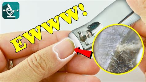 Fingernail Dirty Under The Microscope Youtube