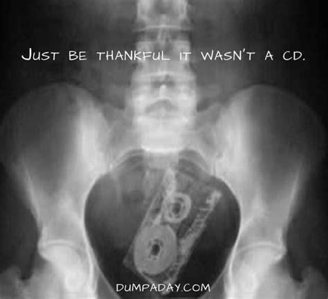 Pin By Angela Lamberth On Funny Pictures X Ray Medical Humor Xray Humor
