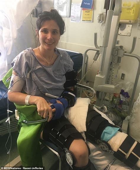 Physiotherapist Has Leg Amputated After 17 Surgeries To Try And Save Limb Following A Car Crash