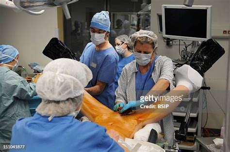 transgender surgery photos and premium high res pictures getty images