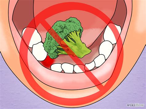 4 Ways To Loosen A Tooth Wikihow