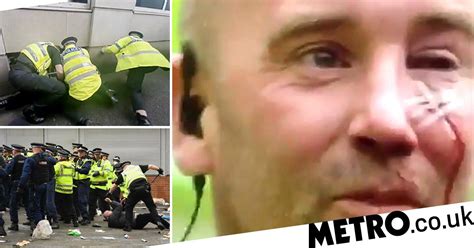 Police Officer Who Had Face Slashed During Man Utd Fan Protests Lucky Not To Lose Sight