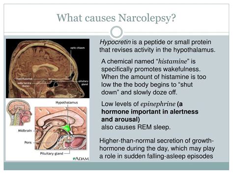 Ppt Narcolepsy Powerpoint Presentation Free Download Id2287289