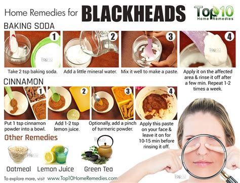 Home Remedies To Get Rid Of Blackheads Fast Top 10 Home Remedies