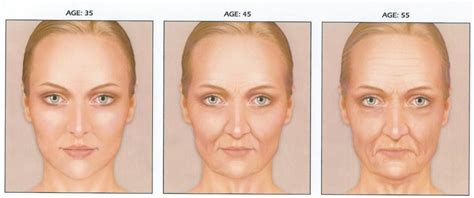 Aging Face Cheeks