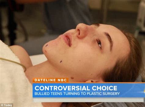 Plastic Surgery Group Grant 15 Year Old Free Nose Job To Stop Bullying