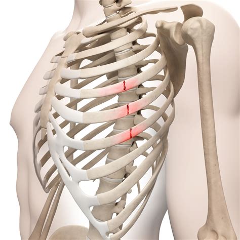 Left Side Abdominal Pain Under Rib Cage