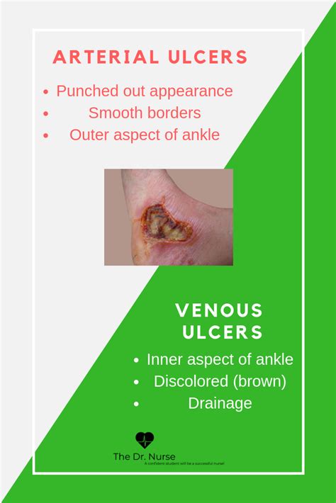 Click Through For This Weeks Weekly Tip Covering Arterial And Venous