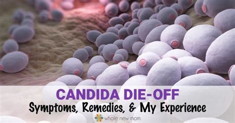 Candida Die Off How To Avoid And Manage It And My Story Whole New Mom