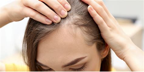 Alopecia Treatments San Luis Obispo Coastal Dermatology