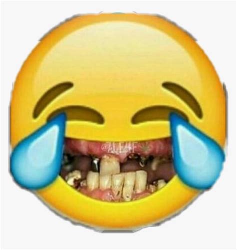 Funny Teeth Png Laughing Emoji With Bad Teeth Transparent Png Kindpng