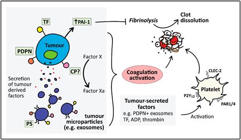 Cancers Free Full Text Cancer Associated Thrombosis An Overview Of