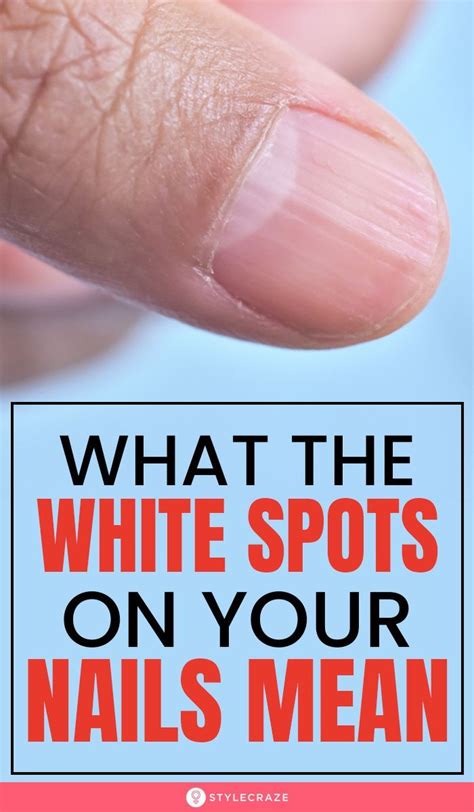 Do You Have White Spots Half Moon On Your Nails Heres What They