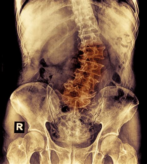 Lower Back Internal Organs Back Pain Cause Examination