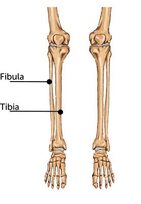 This means the bone stays pretty much in line and can, therefore, heal with little intervention. Broken Tibia Fibula Shin bone Calf | Boston Children's ...