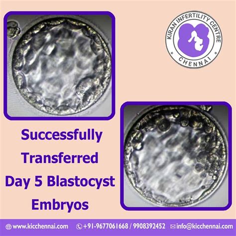 Successful Transfer Day5 Blastocyst Embryos