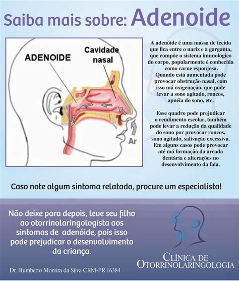 Saiba Mais Sobre A Adenoide Dr Humberto Moreira CRM PR 16384