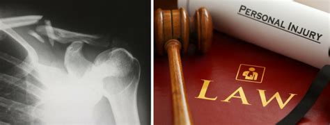 See more of personal injury claim support on facebook. Your guide to making a personal injury claim ...