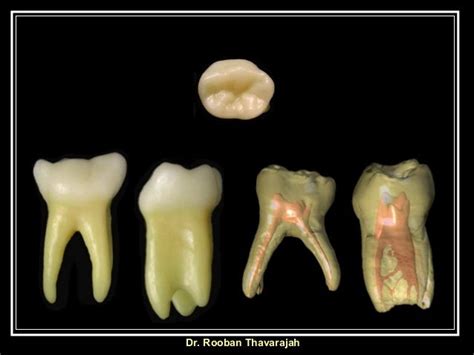 Morphology Of Human Deciduous Mandibular Molar Teeth