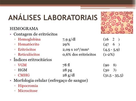 Anemia