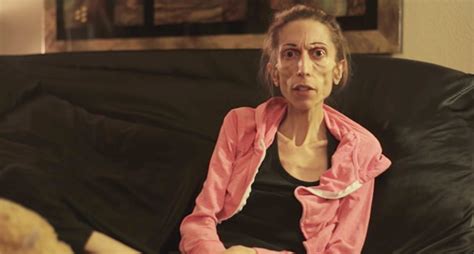 Rachael Farrokh Refused Treatment By Hospitals For Anorexia Finally