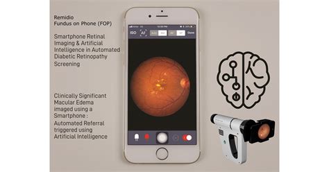 Smartphone Based Retinal Imaging Together With Artificial Intelligence