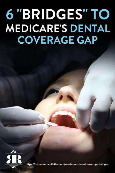 Dental crowns and bridges can be restored as well. 6 "Bridges" To Medicare Dental Coverage Gap | Dental coverage, Dental insurance plans ...