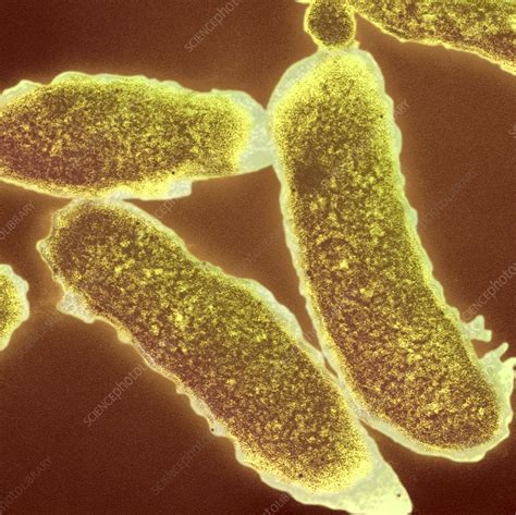 Cholera Bacteria Tem Stock Image C0124990 Science Photo Library