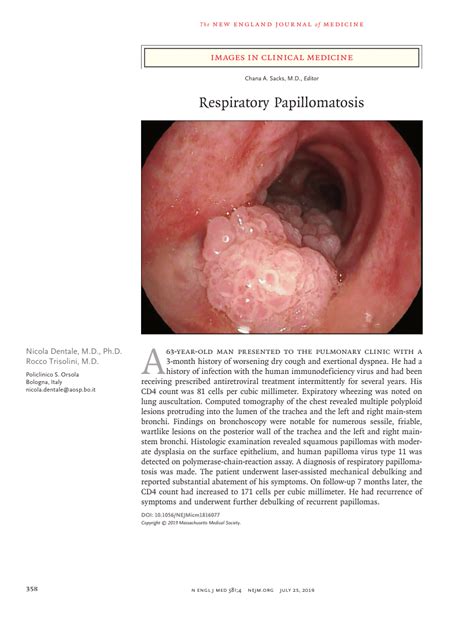 Respiratory Papillomatosis Pathogenesis Enterobius Vermicularis Quiste