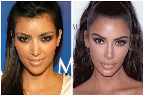 Plastic Surgery Examples Kim Kardashian Plastic Surgery Before After