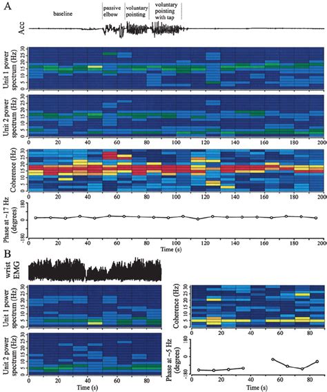 Changes In Phase Relationship Between Oscillatory Stn Neurons Over