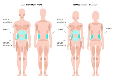 Body planes are hypothetical geometric planes used to divide the body into sections. Abs/Flanks - KleinLipo - Liposuction Surgery of Orange County