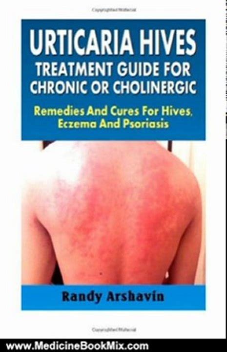 Medicine Book Review Urticaria Hives Treatment Guide For Chronic Or