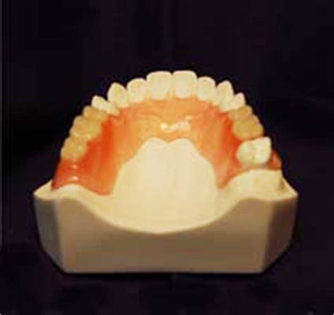 These dental prostheses restore your oral abilities and your smile. Download Valplast Partial Dentures Cost Gif