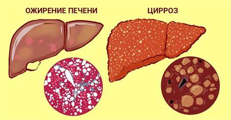 Вылечить печень диета