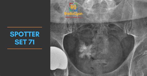 Body Imaging Radiology Cases Spotter Set 71 Radiogyan