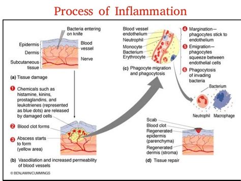 6 Inflammation