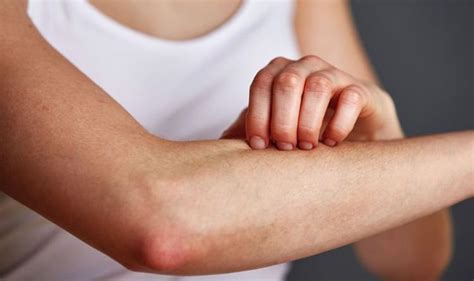 Vitamin B12 Deficiency White Spots On Your Forearms Is A Lesser Known