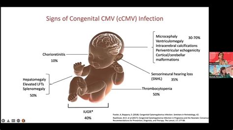 Understanding Congenital Cytomegalovirus Cmv Infection Complications