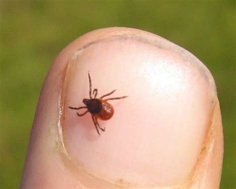 Tick Borne Bacteria That Causes Symptoms Worse Than Lyme Disease Found