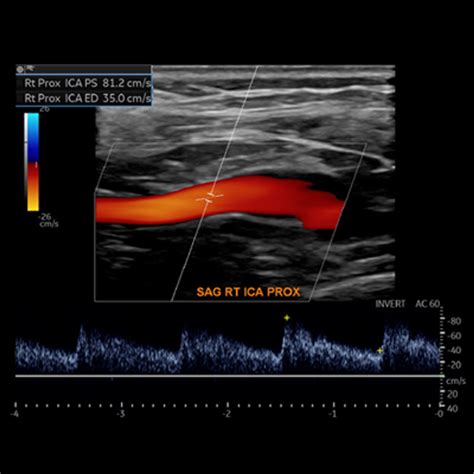 Society For Vascular Medicine Comprehensive Review Of Vascular